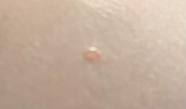 Môžu byť toto ovčie kiahne?