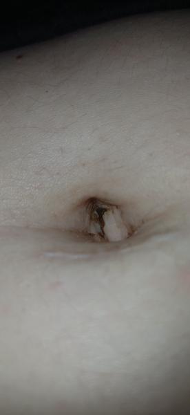 Chrasta v bruchu: Čo s ňou robiť?