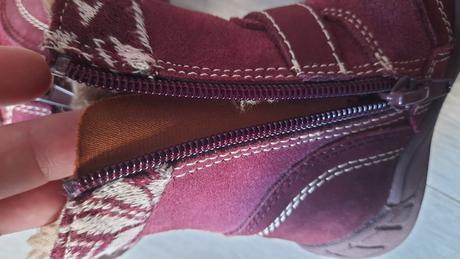 Čižmičky, protetika,20