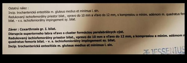 Účinnosť artroskopie pri problémoch s bedrovým kĺbom