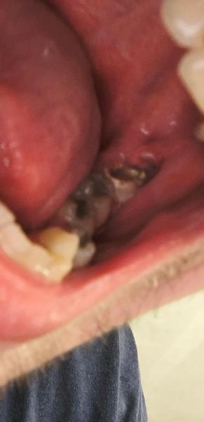 Je hýbajúce sa ďasno príznakom problému?