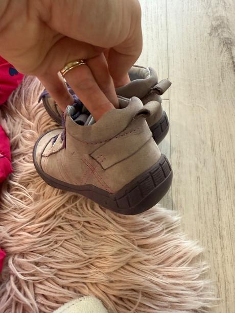 Protetika topanky, protetika,24