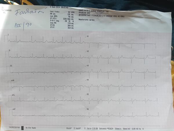 Ako správne interpretovať výsledky EKG?