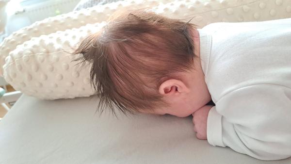 Má moje dieťa zležanú hlavičku?