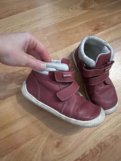 Jesenne barefoot - protetika, protetika,31