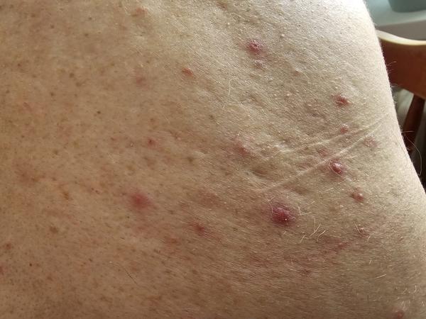 Čo to mám na koži?