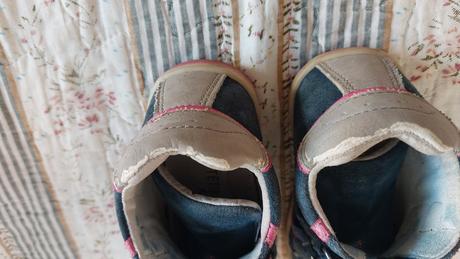 Protetika, protetika,22