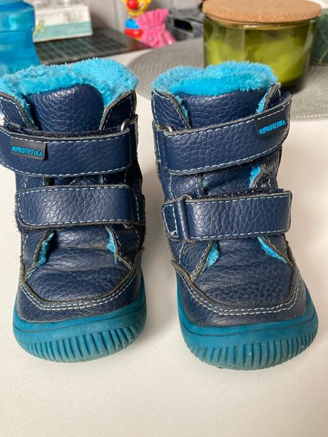 Prechodné topánky protetika, protetika,20