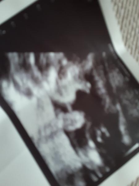 Je podľa vás tento chlapček na fotke?