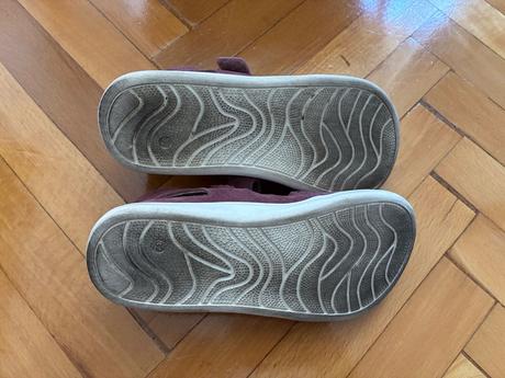 Balerínky barefoot, protetika,32