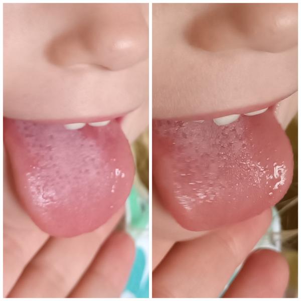 Má dcéra šarlach?