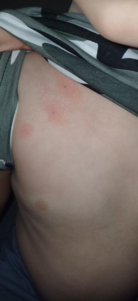 Ako zistiť, či máte doma ploštice alebo blchy?