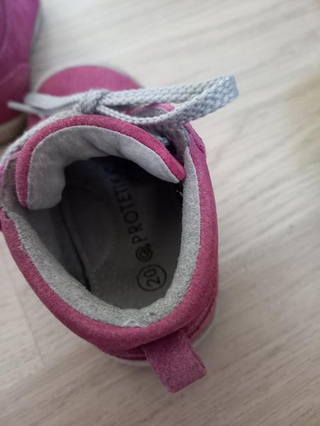 Topanky, protetika,20