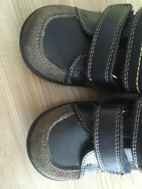 Topanocky protetika, protetika,23