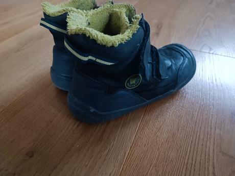 Protetika barefoot, protetika,34