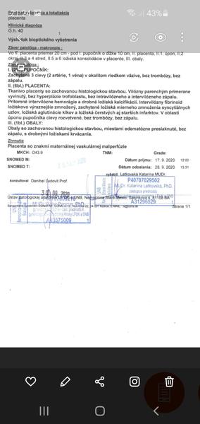 Vysvetlíte mi tieto výsledky?