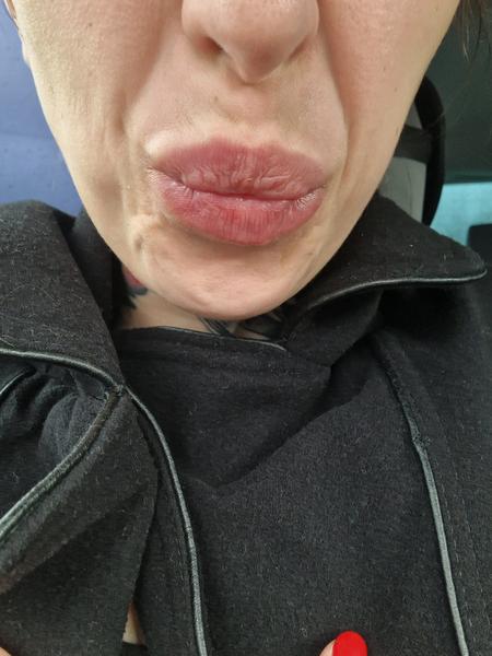 Prečo má 8-mesačný syn kyslý výraz?