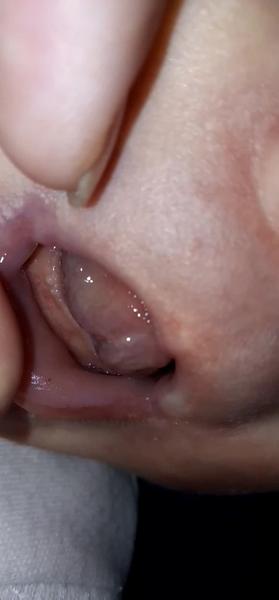 Môže to byť zúbok?