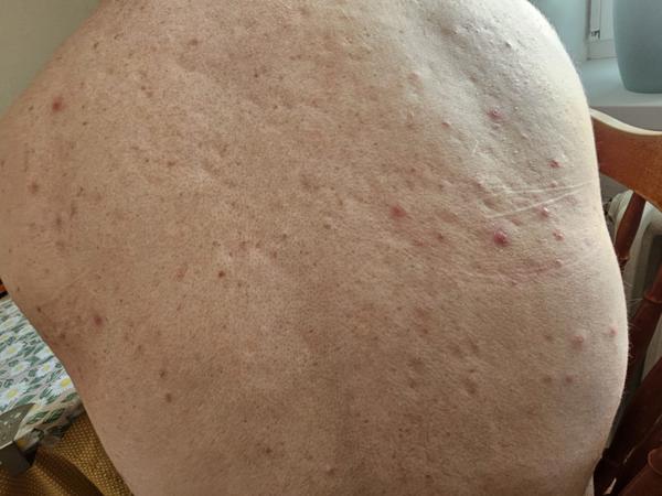 Čo to mám na koži?