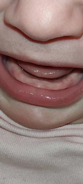 Sú toto už zúbky?