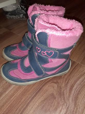 Čižmy sú, protetika,32