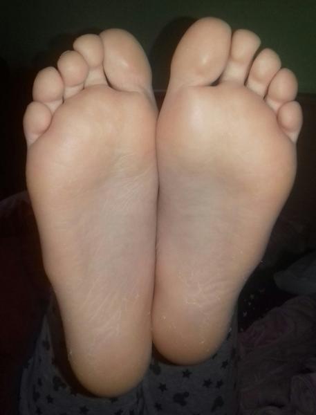 Čo sú to za výbežky na chodidlách 9 ročnej dcéry?
