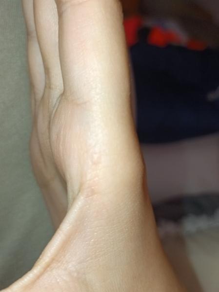 Čo spôsobuje vašu kožnú vyrážku?