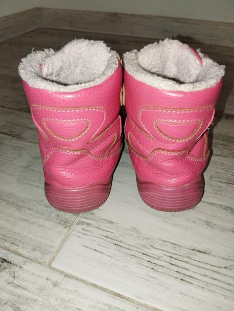 Protetika zimne, protetika,29