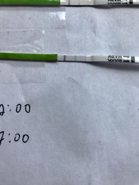 Graf bazálnej teploty ( anovulačný cyklus )