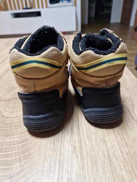 Barefoot protetika, protetika,28