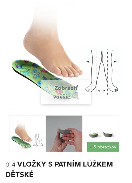 Svorto vložky na vpadnuté členky. Sú lepšie než Formthotics?