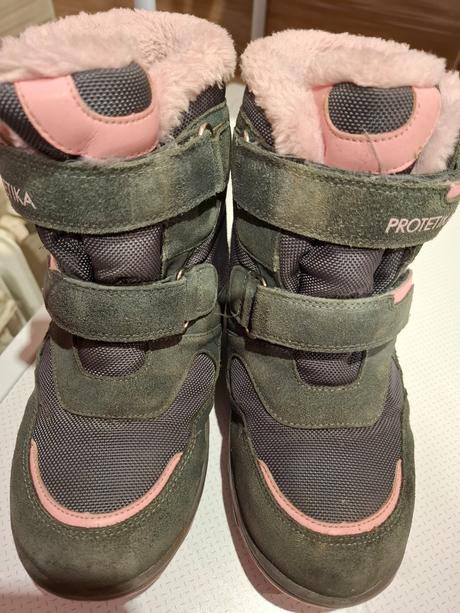 Zimne cizmicky, protetika,33