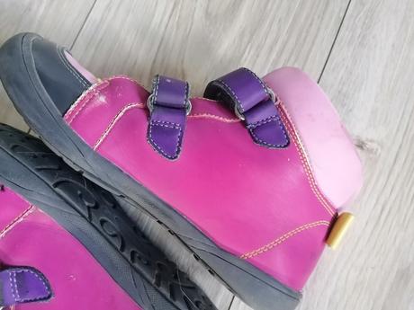 Topánky kotníkové protetika, protetika,33