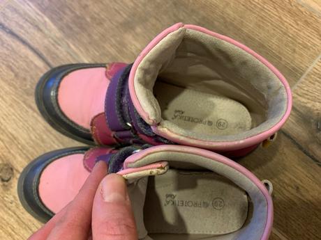 Protetika topanky, protetika,29