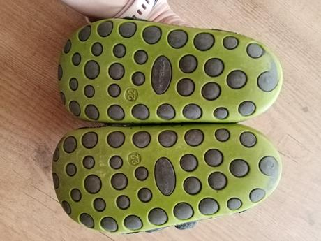 Topanky protetika 22, protetika,22