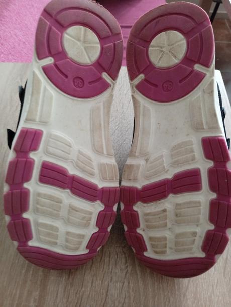 Topanky protetika c.34 top stav, protetika,34