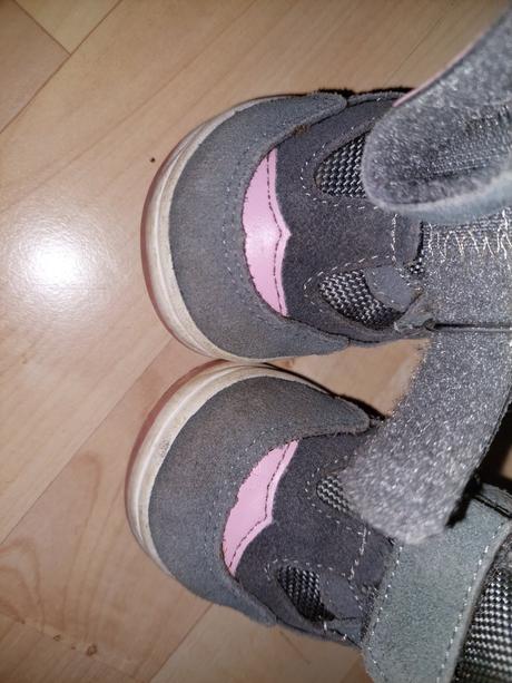 Protetika čižmičky, protetika,20