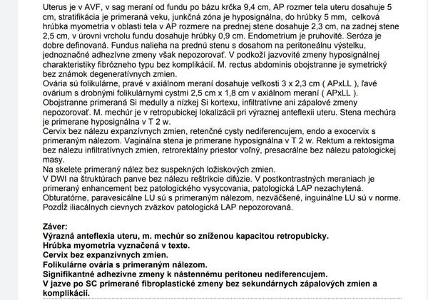 Aký je Váš názor na moje výsledky z MR?