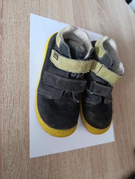 Barefoot protetika, protetika,31