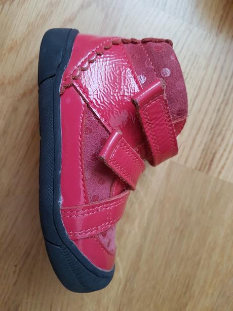 Topánočky barefoot protetika, protetika,22