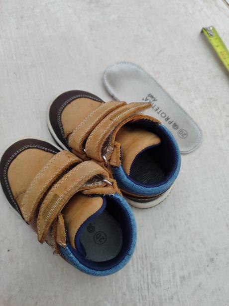 Detské topánky protetika, protetika,20