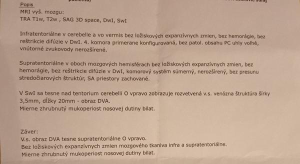 Aký je výsledok z mojej magnetickej rezonancie mozgu?