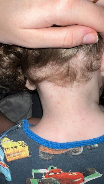 Má môj 10-mesačný syn potničky?