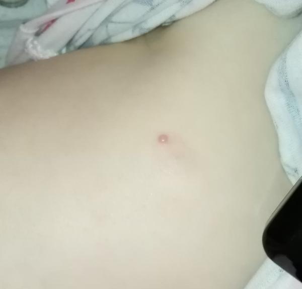 Problém ročnej dcérky