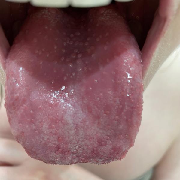 Je toto malinový jazyk?