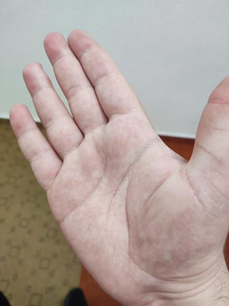 Čo to mám na rukách?