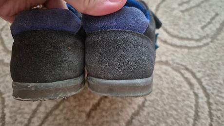 Prechodné topánky, protetika,28