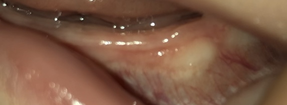 Môže ísť o zúbok?