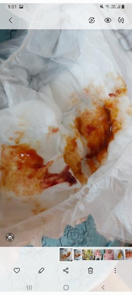 Je v poriadku, keď popri liečbe dieťa kaká do červena?