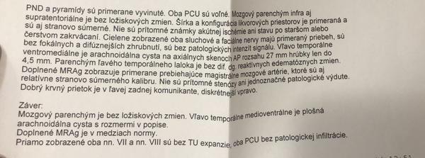 Sú výsledky z MRI mozgu v poriadku?